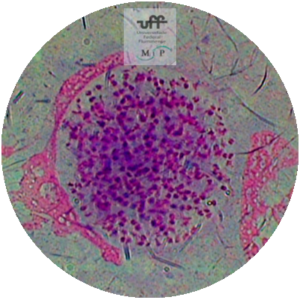 Bradizoita de Toxoplasma gondii