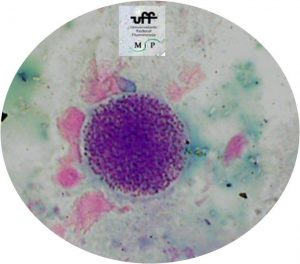 toxoplasma-gongii-bradizoita-1