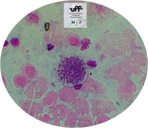 toxoplasma-gongii-bradizoita-2