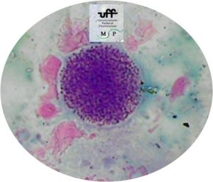 toxoplasma-gongii-bradizoita-3