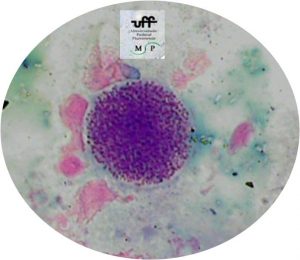 toxoplasma-gongii-bradizoita-4