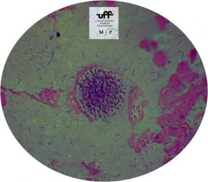 toxoplasma-gongii-bradizoita-5
